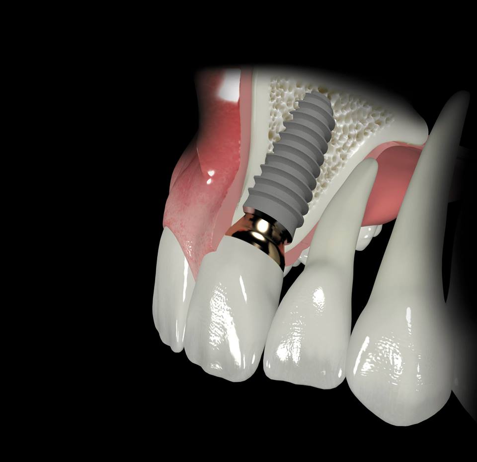 Αντίγραφο του 1907762_310323072475201_7170992687951504952_n.jpg